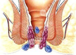 肛门流脓会是什么病