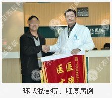 环状混合痔、肛瘘病愈案例