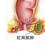 福州治肛周红肿好的医院
