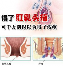 福州肛乳头瘤是什么？