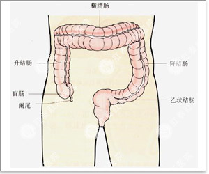 大肠息肉有什么危害