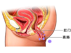 肛门湿疹对人体有哪些危害？